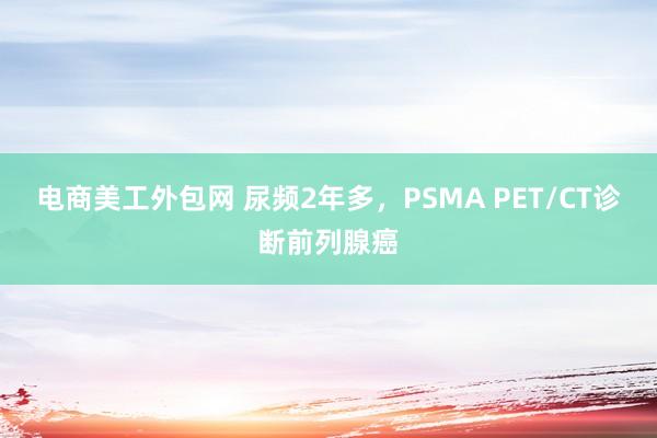 电商美工外包网 尿频2年多，PSMA PET/CT诊断前列腺癌